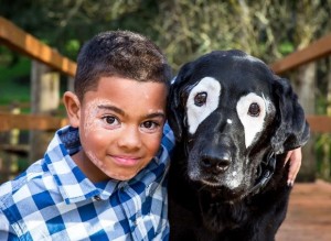 Criança e Cachorro com vitiligo